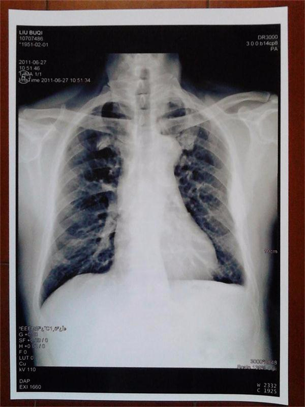 湖南醫(yī)用B超/放射膠片—醫(yī)用噴墨膠片