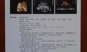 談醫(yī)用彩超膠片的運(yùn)用室內(nèi)環(huán)境有什么