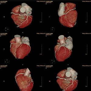 核醫(yī)學(xué)放射膠片—醫(yī)用CT膠片