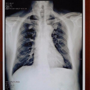 醫(yī)用B超/放射膠片—醫(yī)用噴墨膠片