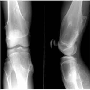 醫(yī)用B超/放射膠片—醫(yī)用紙質(zhì)膠片