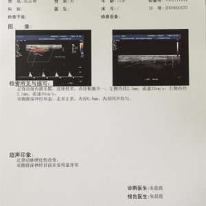 醫(yī)用B超/放射膠片—醫(yī)用激光膠片