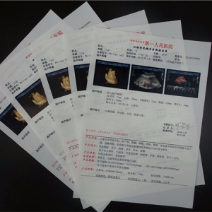 醫(yī)用激光膠片—激光瓷白膠片