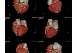 醫(yī)用放射膠片的材料成分和優(yōu)點(diǎn)