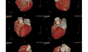 醫(yī)用放射膠片的材料成分和優(yōu)點(diǎn)